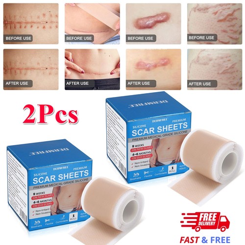 2pcs silicone scar sheet - scar,