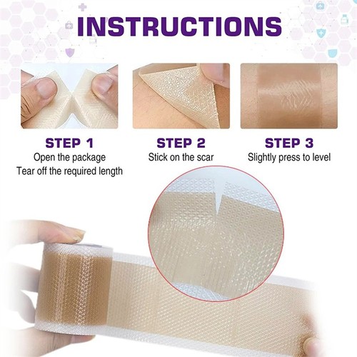 Medical grade scar removal - grade,