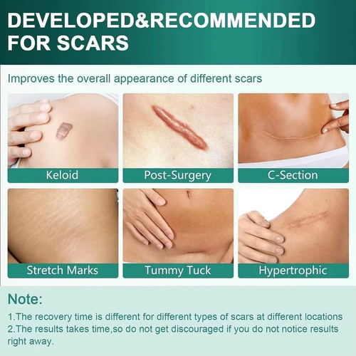 Collagen scar tape - collagen, face