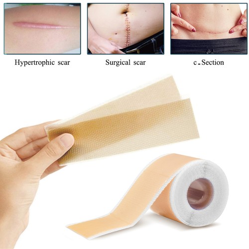 Medical grade silicone - medical, scar