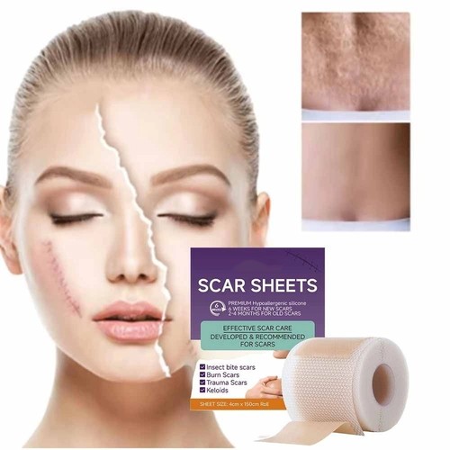 Silicone scar sheets - sheets,