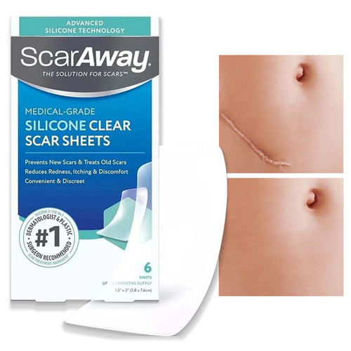Scar away medical grade clear - scar,