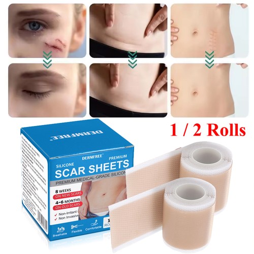 2pcs silicone scar sheets - 2pcs,