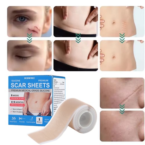 Collagen scar tape - collagen, sheets