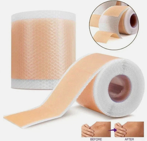 Medical grade silicone scar - grade,