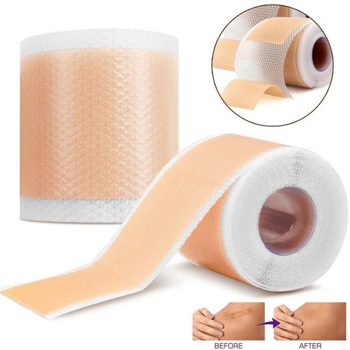 Collagen scar tape - collagen,
